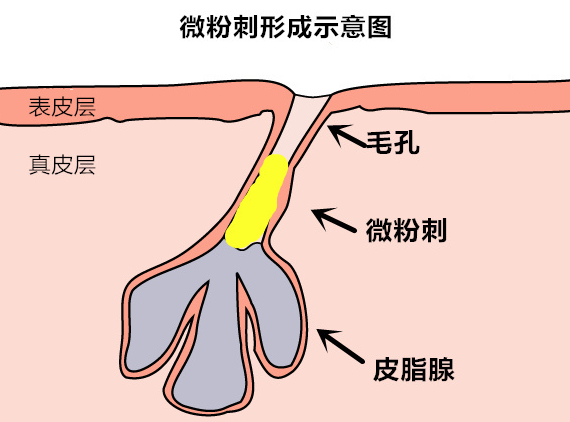 <a href=http://www.n1239.cn/tag/lianshang/ target=_blank ><a href=http://www.n1239.cn/tag/lian/ target=_blank >Ę</a></a>L<a href=http://www.n1239.cn/tag/bihexingfenci/ target=_blank >]<a href=http://www.n1239.cn/tag/fenci/ target=_blank >۴</a></a>һ㶼ʲô<a href=http://www.n1239.cn/tag/yuanyin/ target=_blank >ԭ</a>