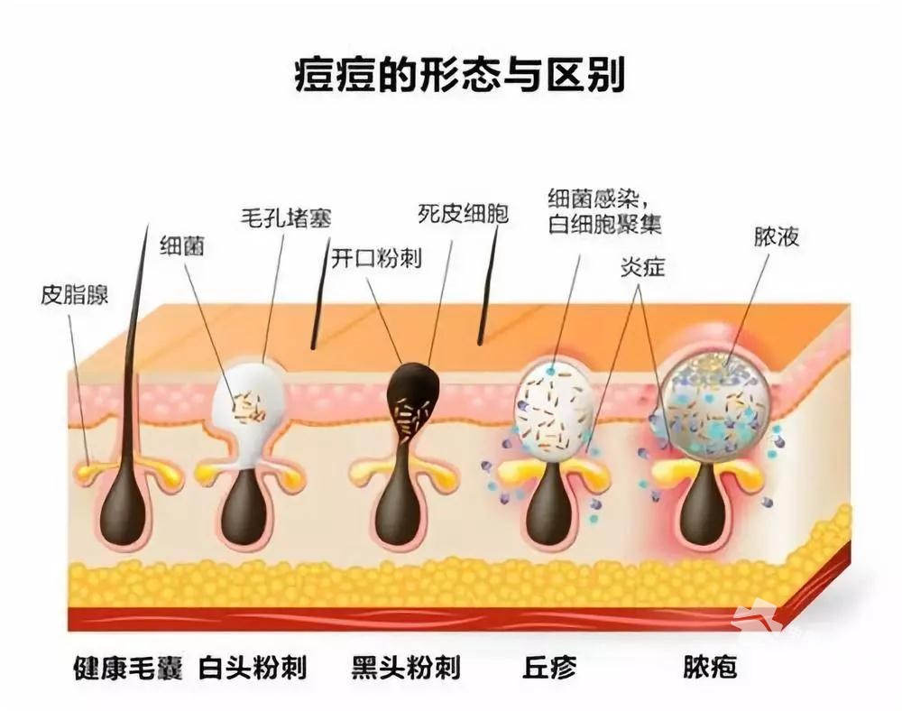 lf<a href=http://www.n1239.cn/tag/buchangdou/ target=_blank ><a href=http://www.n1239.cn/tag/changdou/ target=_blank >L<a href=http://www.n1239.cn/tag/dou_3982/ target=_blank ></a></a></a>ֻ^eҵ<a href=http://www.n1239.cn/tag/dou/ target=_blank ><a href=http://www.n1239.cn/tag/dou_3982/ target=_blank ></a></a><a href=http://www.n1239.cn/tag/fangfa/ target=_blank ></a>……